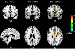 E' vero amore? Lo scoprirà risonanza magnetica cervello